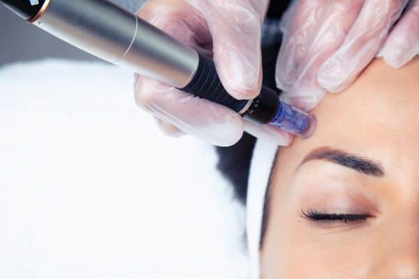 Explaining Total Skin Tightening Treatment and What to Expect 2 What Skin Concerns Can Total Skin Tightening Treatment Help With Woking?
