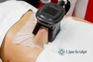 Does Fat Freezing At Home Work? 3 Fat freezing at home from Lipo Sculpt Woking