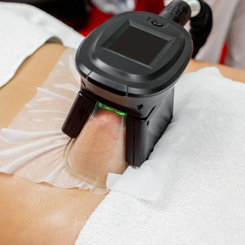 Fat Freezing treatment Woking